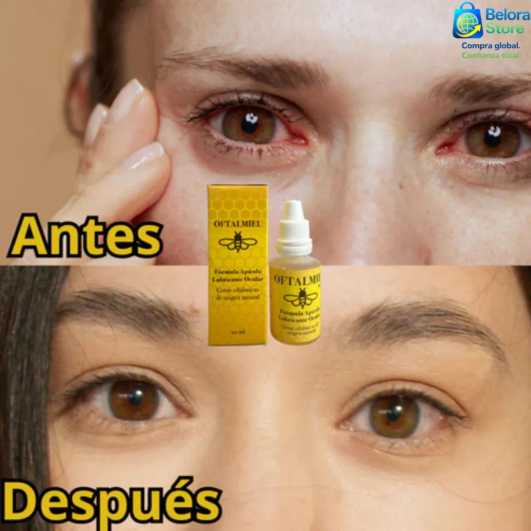 Lubrimiel VisionCare