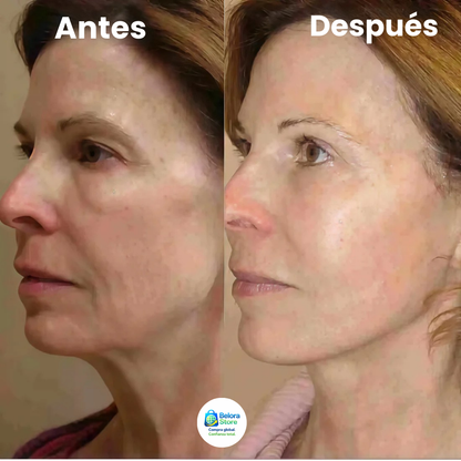 Lovilds™ Crema Reafirmante
